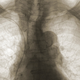 Illustration for article titled Implant Jamming Shield Will Keep Body Hackers from Giving You a Heart Attack